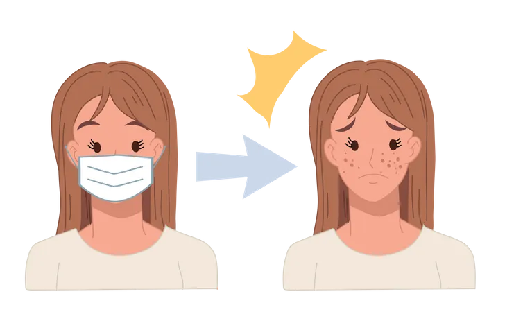 Acné causée par le port d'un masque facial  Illustration