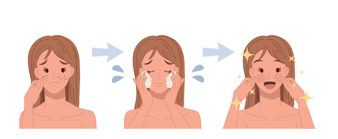 Acne treatment process for clear face  Illustration