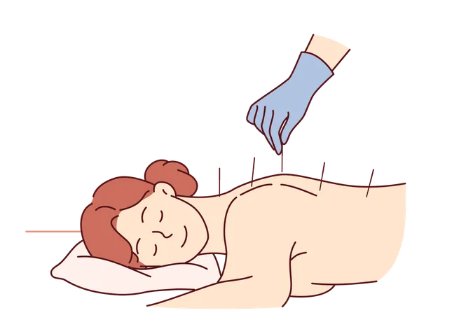 Acupuncture Procedure From Traditional Chinese Medicine For Woman Lying At Reception In SPA Center Process Of Acupuncture And Needle Therapy Allows You To Get Rid Of Pain In Spine After Injury Illustration