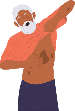 Aged senior man patient suffering from psoriasis disease  Illustration
