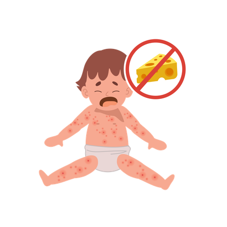 Alergia a los alimentos para bebés por queso  Ilustración