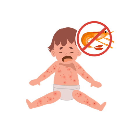 Alergia alimentar para bebês a frutos do mar ou mariscos  Ilustração