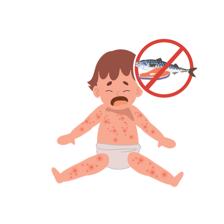 Alergia alimentar para bebês de frutos do mar ou peixe  Ilustração