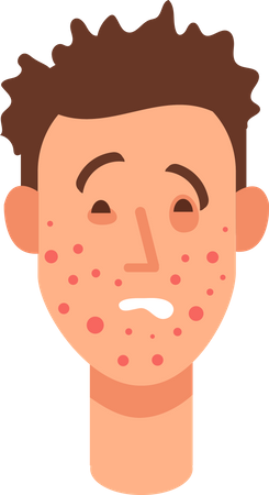Allergic rash skin  Illustration