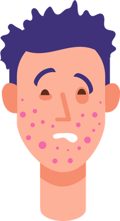 Allergic rash skin  Illustration