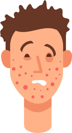 Allergic rash skin  Illustration