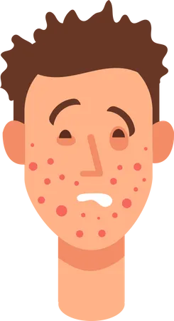 Allergic rash skin  Illustration