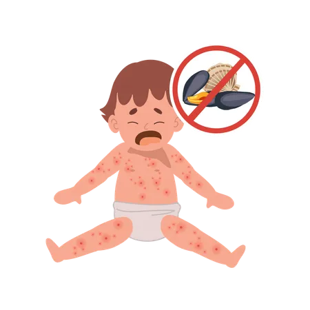 Allergic Reactions In Infants Baby With Skin Rash Baby Food Allergy From Seafood Or Shellfish Shell Free Illustration