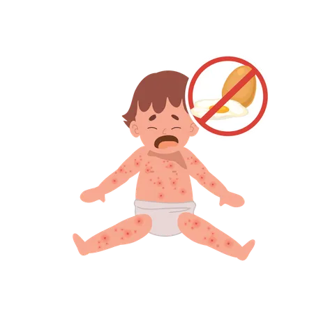 Allergic Reactions In Infants Baby With Skin Rash Baby Food Allergy From Egg Egg Free Illustration