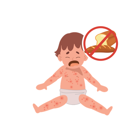 Allergic Reactions in Infants  Illustration