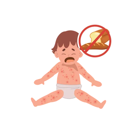 Allergic Reactions in Infants  イラスト