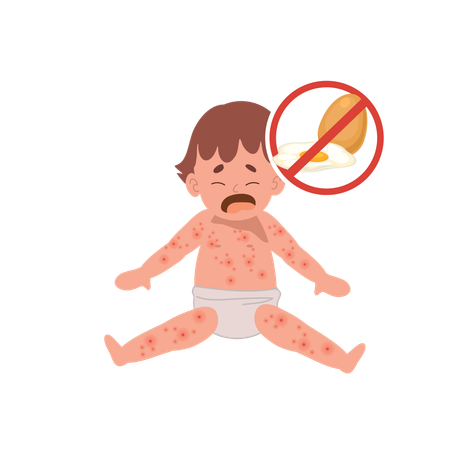 Allergic Reactions in Infants  Illustration