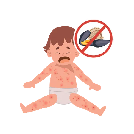 Allergic Reactions in Infants  Illustration