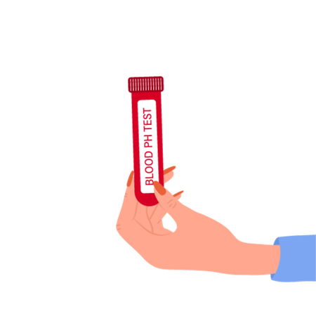 Análisis de pH en sangre  Ilustración