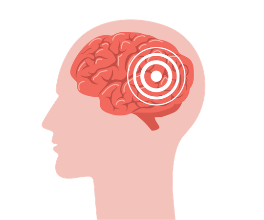 Anatomia do cérebro. Cabeça humana em perfil com cérebro vermelho dentro. Dor de cabeça. Símbolo de enxaqueca isolado em fundo branco  Ilustração