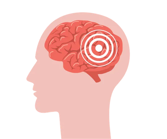 Anatomia do cérebro. Cabeça humana em perfil com cérebro vermelho dentro. Dor de cabeça. Símbolo de enxaqueca isolado em fundo branco  Ilustração