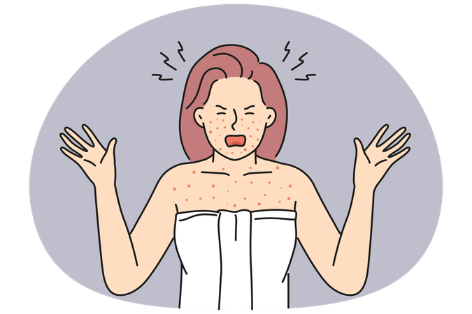 体のアレルギーに悩む怒った女性  イラスト