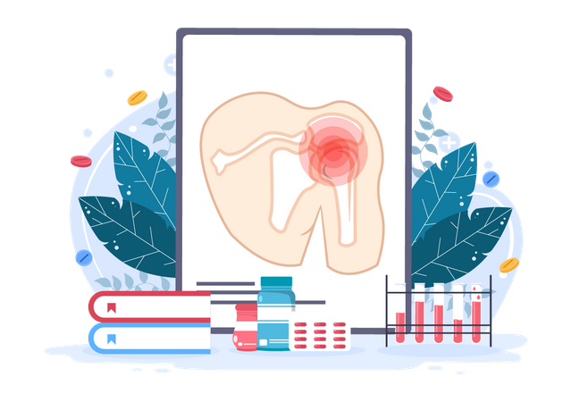 Arthritis-Tag  Illustration