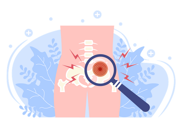Arthritis-Untersuchung  Illustration