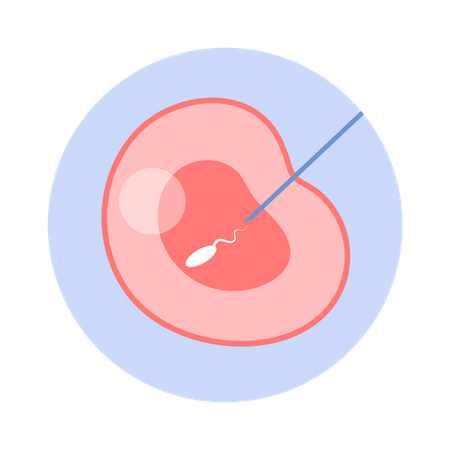 Artificial fertilization of woman egg  Illustration