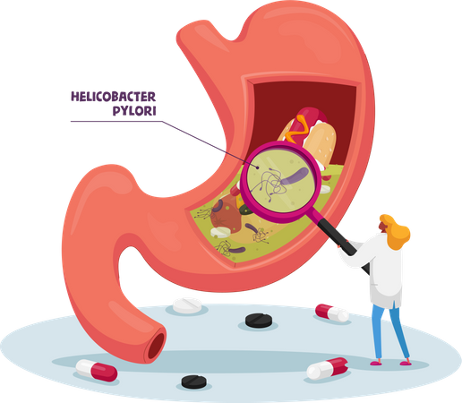 Arzt mit Lupe lernt kranken Magen mit Helicobacter Pylori-Krankheit oder Gastritis  Illustration