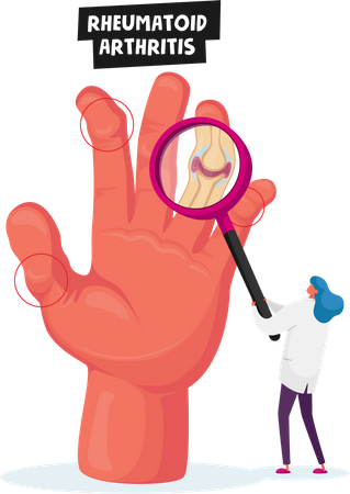 Arzt untersucht entzündete Fingergelenke bei medizinischer Untersuchung  Illustration