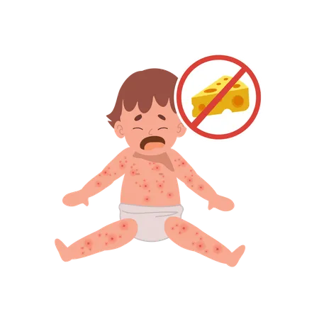 Allergic Reactions In Infants Baby With Skin Rash Baby Food Allergy From Cheese Illustration