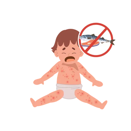Allergic Reactions In Infants Baby With Skin Rash Baby Food Allergy From Seafood Or Fish Illustration