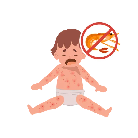 Baby Food Allergy from seafood or shellfish  Illustration