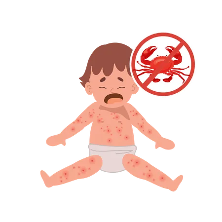 Allergic Reactions In Infants Baby With Skin Rash Baby Food Allergy From Seafood Or Shellfish Crab Free Illustration