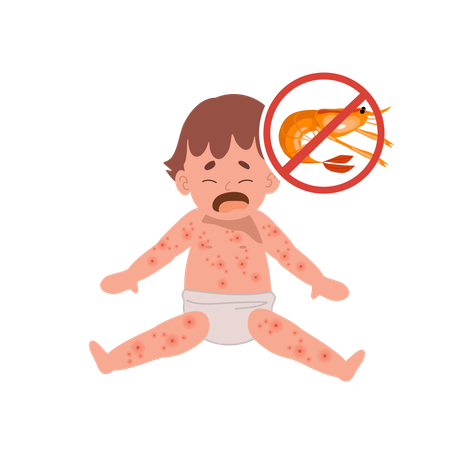 Baby Food Allergy from seafood or shellfish  Illustration