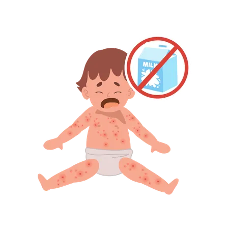 Allergic Reactions In Infants Baby With Skin Rash Baby Food Allergy From Lactose Milk Milk Free Illustration