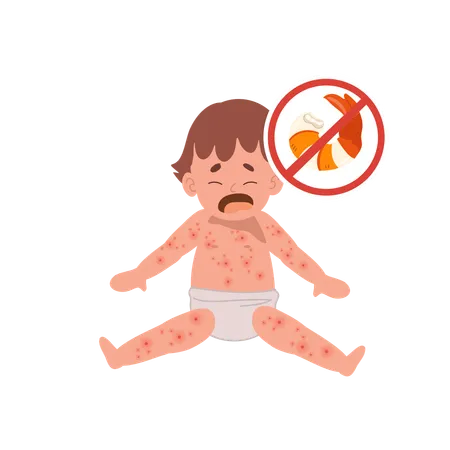 Allergic Reactions In Infants Baby With Skin Rash Baby Food Allergy From Seafood Or Shellfish Shrimp Free Illustration