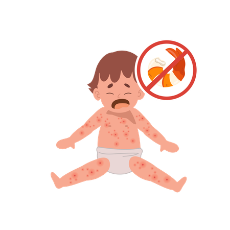 Baby with skin rash  Illustration