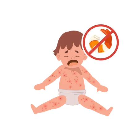 Baby with skin rash  Illustration