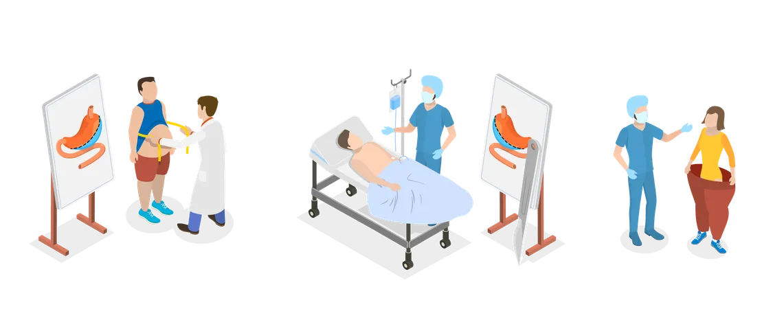 3 D Isometric Flat Vector Conceptual Illustration Of Bariatric Surgery Vertical Sleeve Gastrectomy Illustration