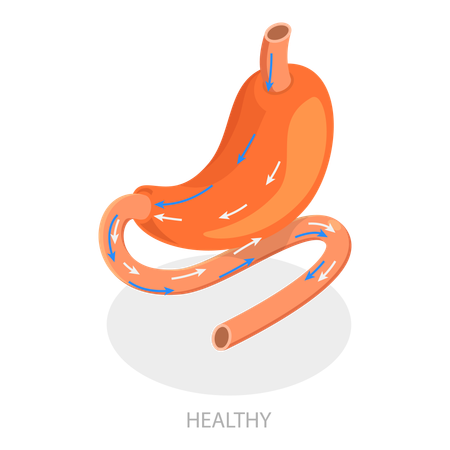 Bariatric Surgery  Illustration