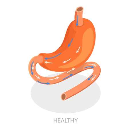 Bariatric Surgery  Illustration