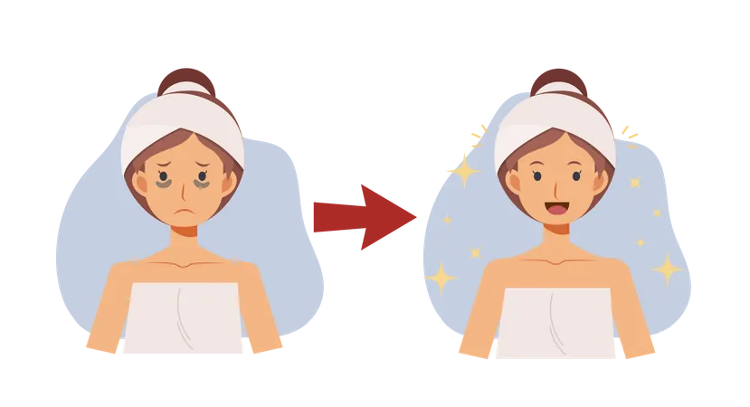 Skin Care Concept Before And After Of Circles Under Your Eyes Problem Flat Vector Cartoon Character Illustration イラスト
