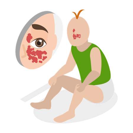 Birthmark Stain on Face  Illustration