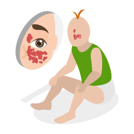 Birthmark Stain on Face  Illustration