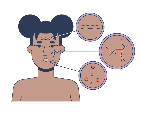 Black woman facial skin conditions diagram  Illustration