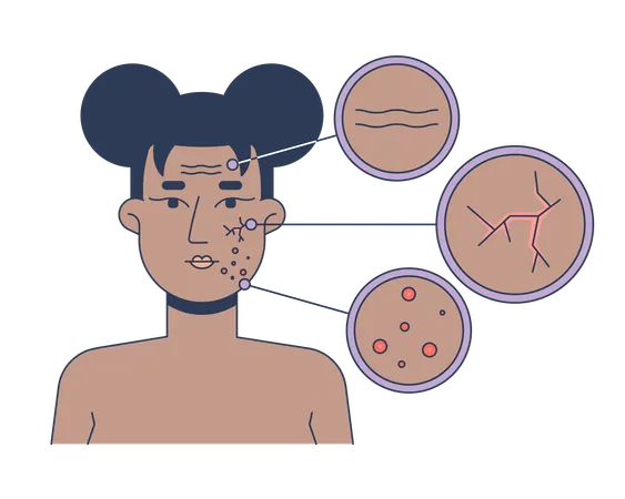 Black woman facial skin conditions diagram  Illustration