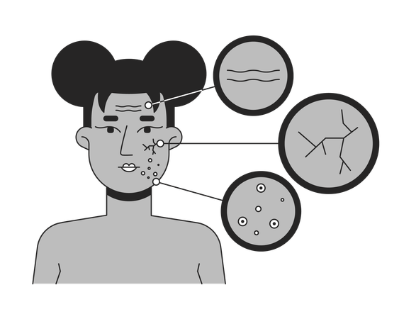 Black woman facial skin conditions diagram  Illustration