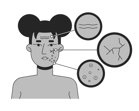 Black woman facial skin conditions diagram  Illustration
