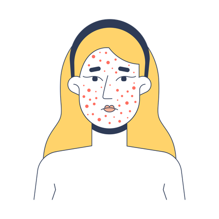 Blonde woman acne breakout skin problem  Illustration