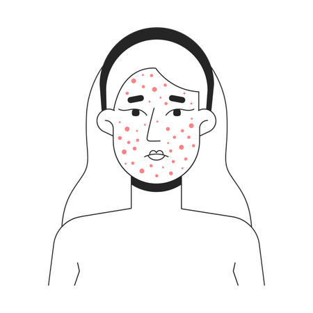 Blonde woman acne breakout skin problem  Illustration