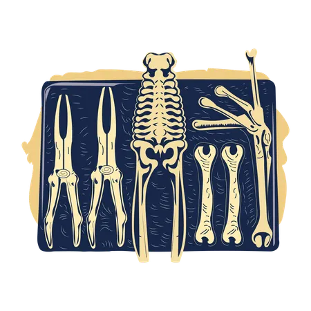 Bone Forceps  Illustration