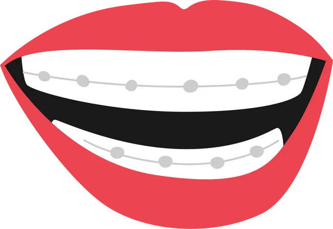 Caractéristiques de la bouche avec appareil dentaire  Illustration