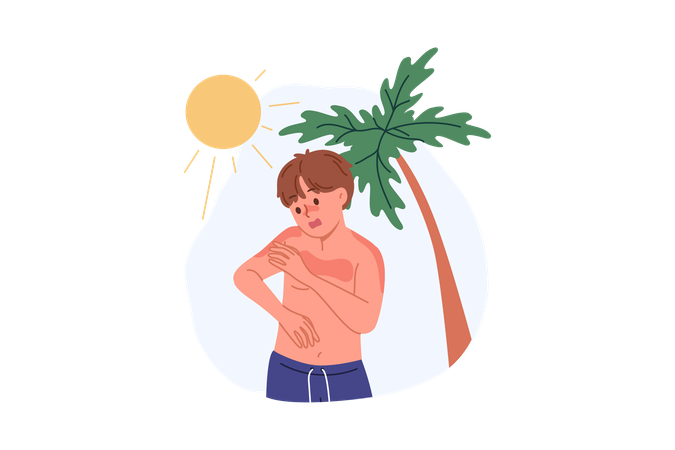 Boy received sunburn due to ultraviolet allergy or heliophobia standing on beach with palm tree  Illustration